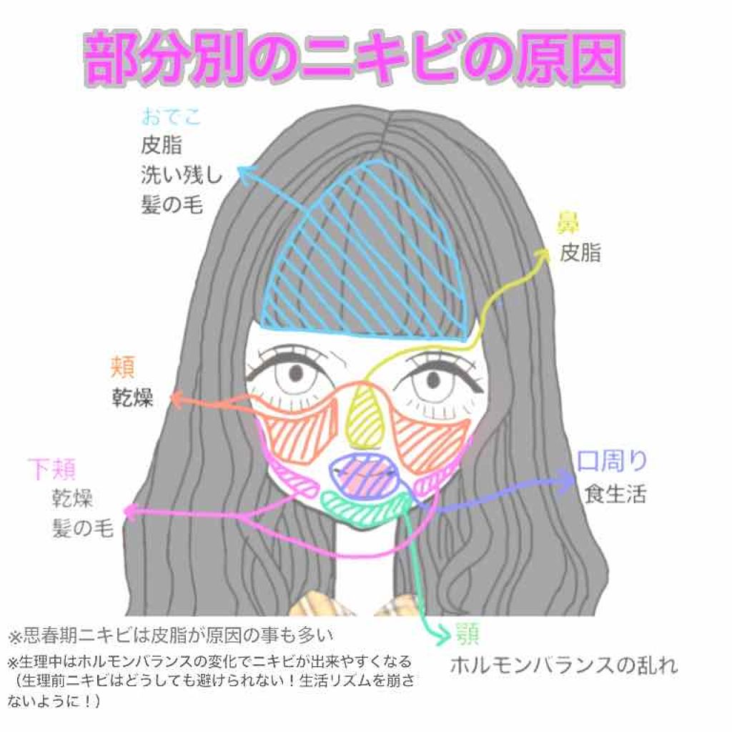 ハトムギ化粧水(ナチュリエ スキンコンディショナー R )/ナチュリエ/化粧水を使ったクチコミ（2枚目）