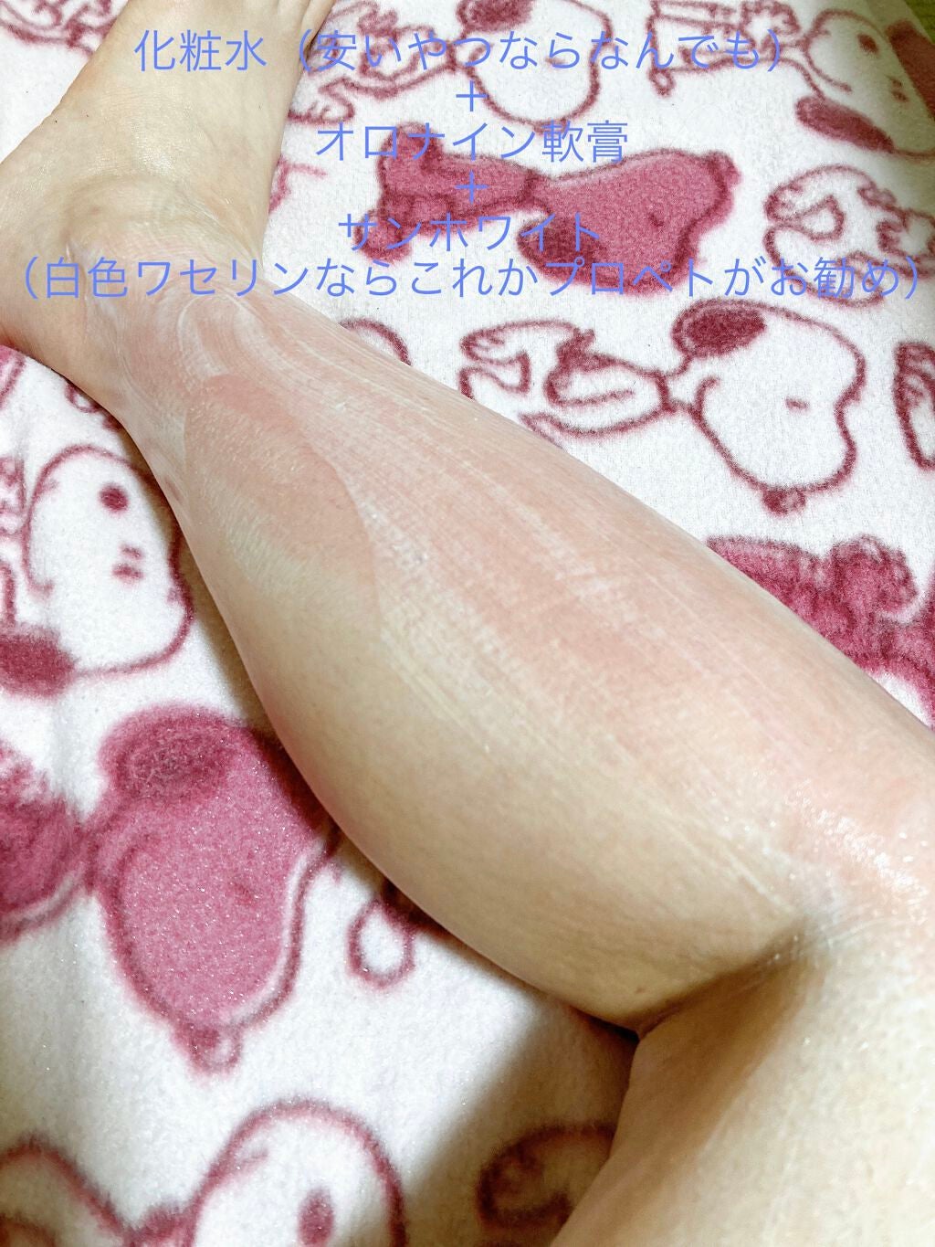 オロナインH軟膏 (医薬品)/オロナイン/その他を使ったクチコミ(2枚目)