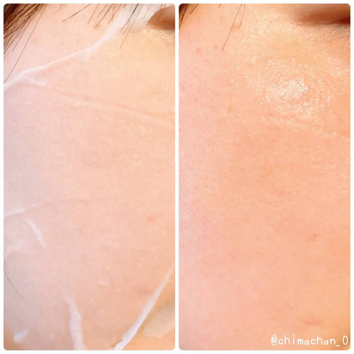 ピックアンドクイックマスク/DEWYTREE/シートマスク・パックを使ったクチコミ（3枚目）