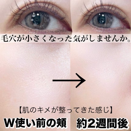 リードルショット700/VT/美容液を使ったクチコミ(6枚目)