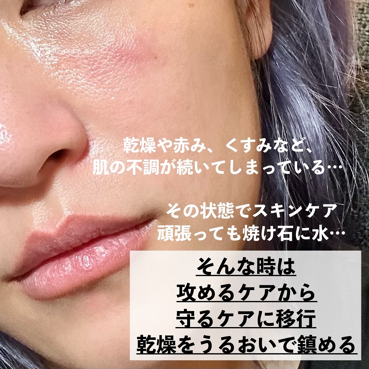 ディープブーストセラム/ブルーミオ/美容液を使ったクチコミ（2枚目）