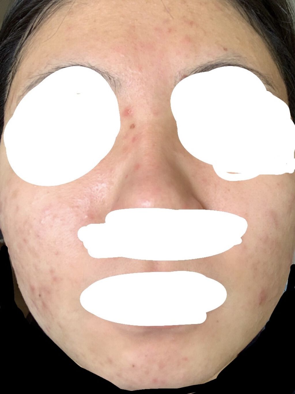 ハトムギ化粧水(ナチュリエ スキンコンディショナー R )/ナチュリエ/化粧水を使ったクチコミ（2枚目）