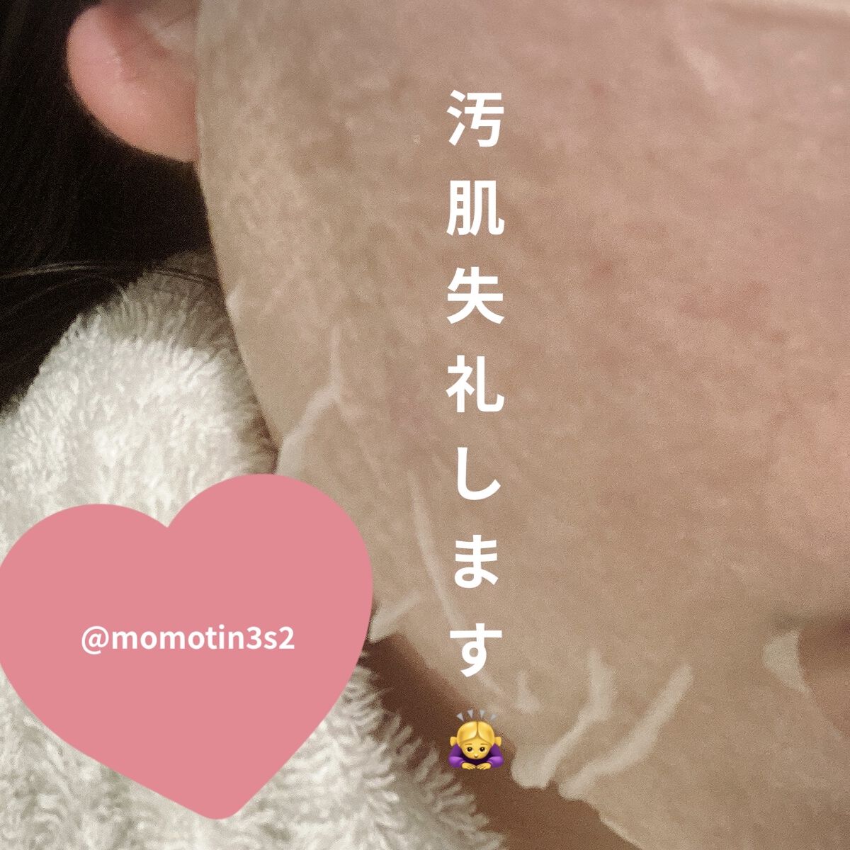 CICA デイリースージングマスク/VT/シートマスク・パックを使ったクチコミ（3枚目）