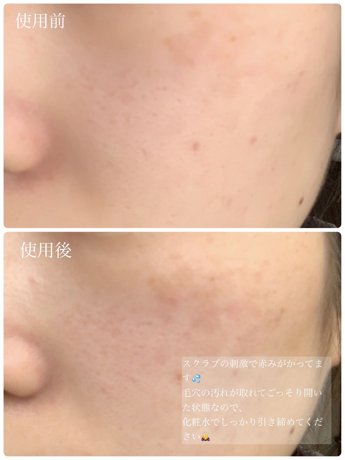 ブラックシュガー パーフェクト エッセンシャル スクラブ2X/SKINFOOD/洗い流すパック・マスクを使ったクチコミ（3枚目）