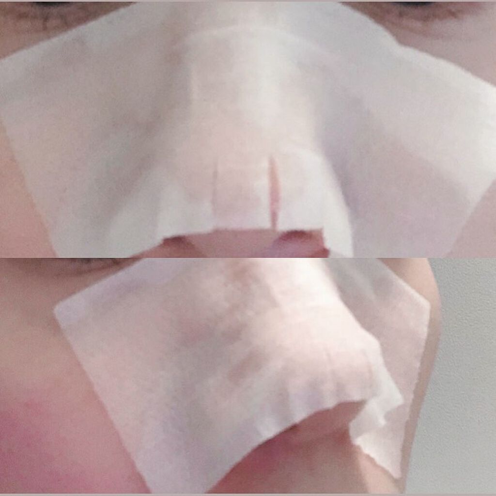 BHクリアノーズパック/CucuporeC/シートマスク・パックを使ったクチコミ(3枚目)