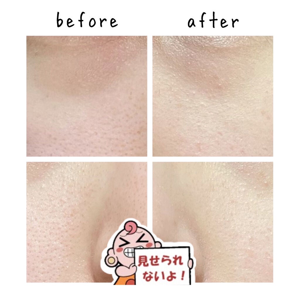 ドクタージャルト シカペア リカバー (第2世代)/Dr.Jart+/フェイスクリームを使ったクチコミ(3枚目)