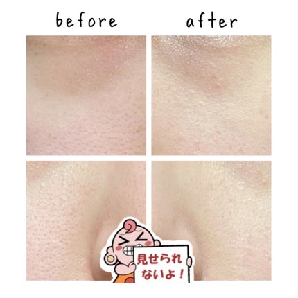 ドクタージャルト シカペア リカバー (第2世代)/Dr.Jart+/フェイスクリームを使ったクチコミ(3枚目)