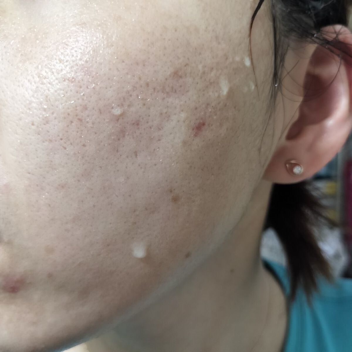 ワセリンHG チューブ (化粧用油)/大洋製薬/ボディクリームを使ったクチコミ（2枚目）