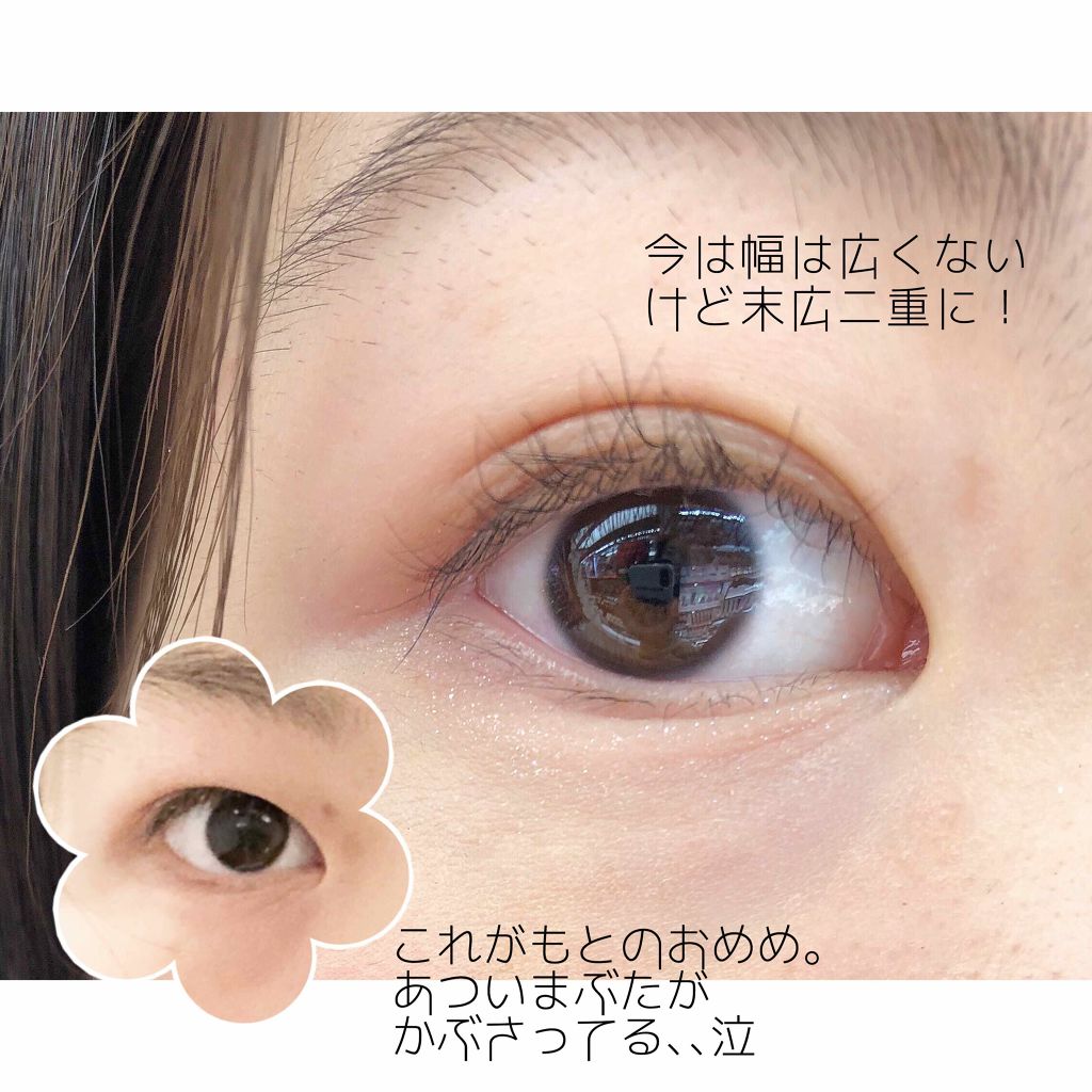 【旧品】オリシキ アイリッドスキンフィルム/D-UP/二重まぶた用アイテムを使ったクチコミ（2枚目）