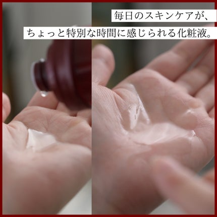 オイデルミン エッセンスローション/SHISEIDO/化粧水を使ったクチコミ(4枚目)