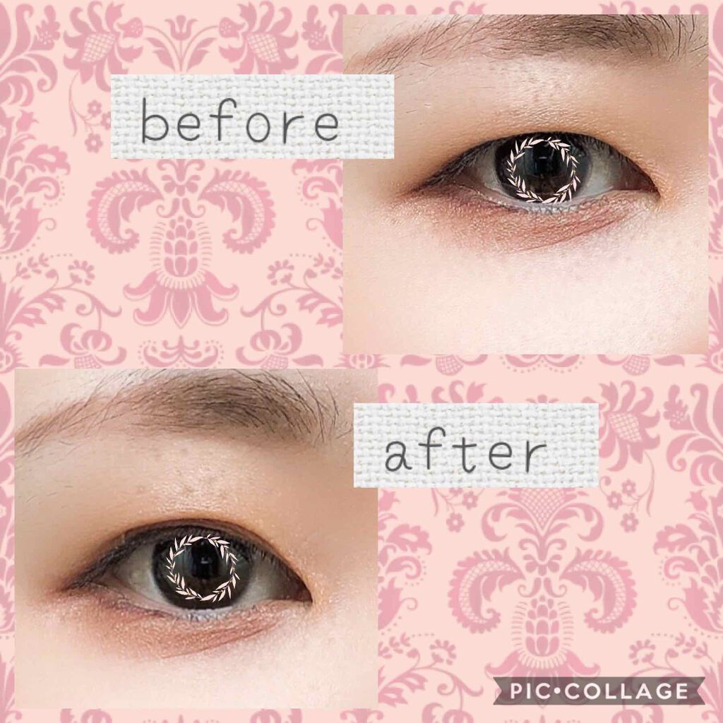 メザイク クリップ カッター ファイバー専用カッター/メザイク/二重まぶた用アイテムを使ったクチコミ(3枚目)