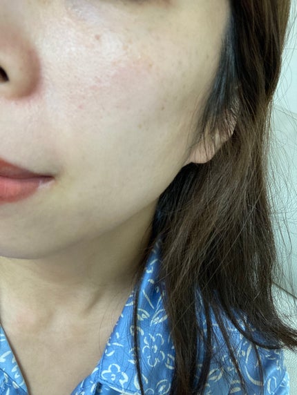 バイオ コンディショニング エッセンス/IOPE/ブースター・導入液を使ったクチコミ(3枚目)