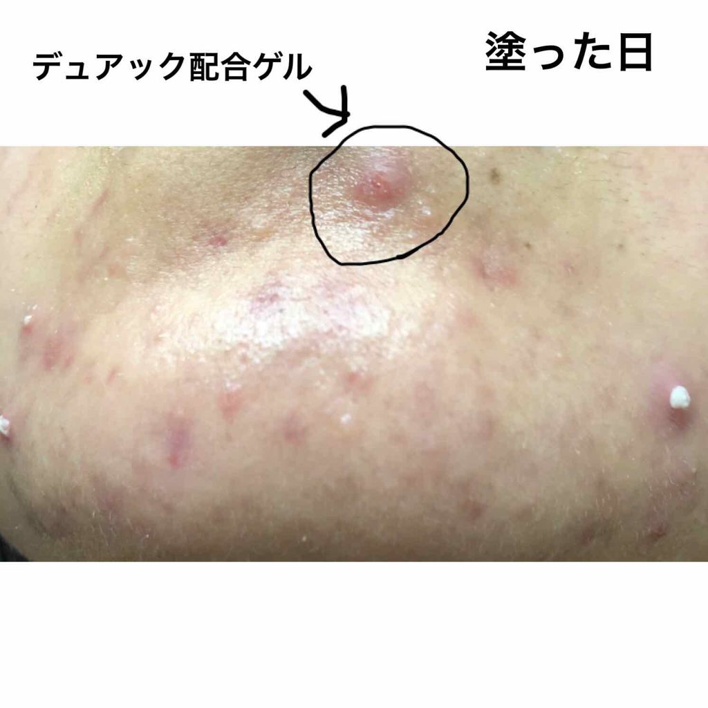 スキンケアセット（とてもしっとり）/IHADA/トライアルキットを使ったクチコミ（2枚目）