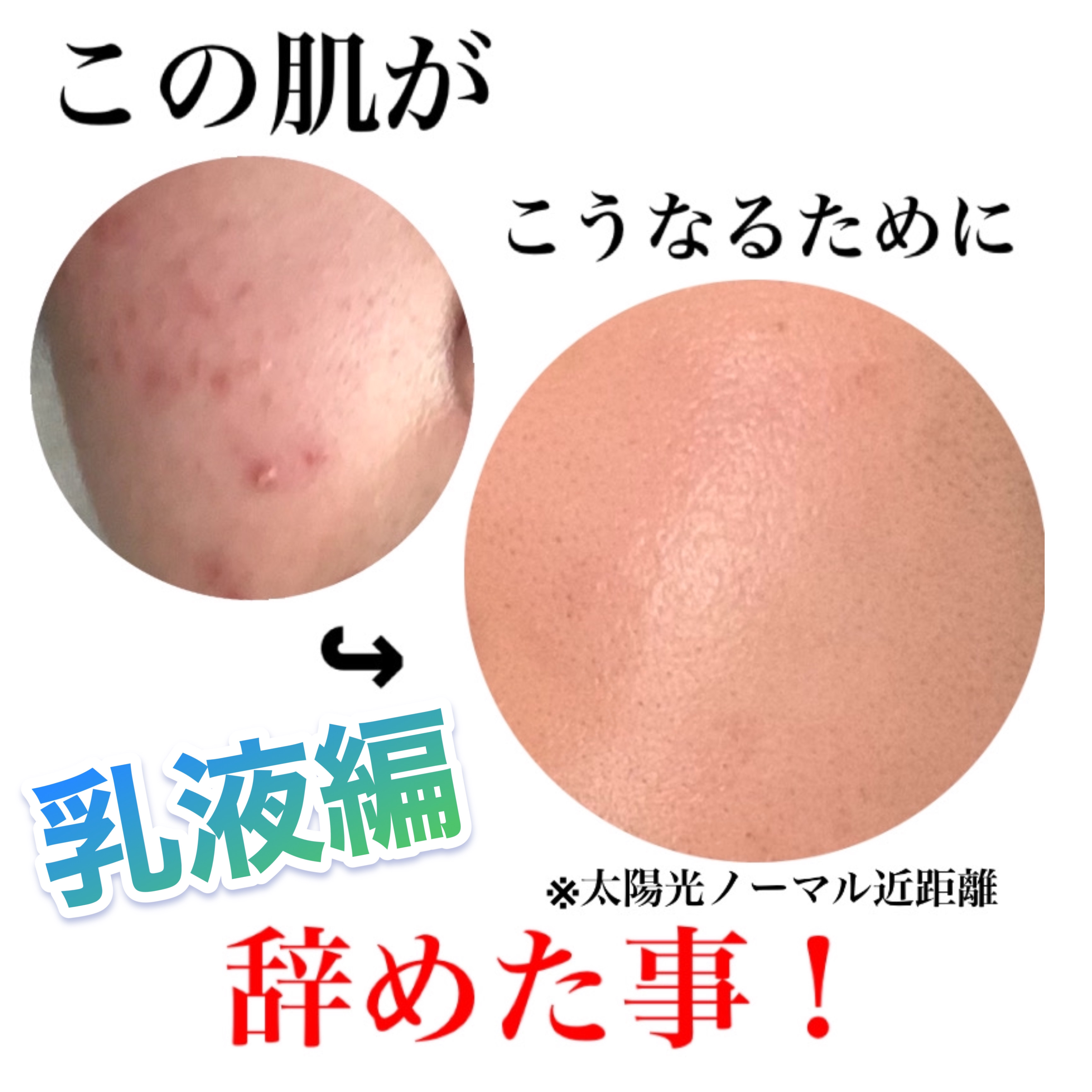 潤浸保湿 乳液/キュレル/乳液を使ったクチコミ（1枚目）