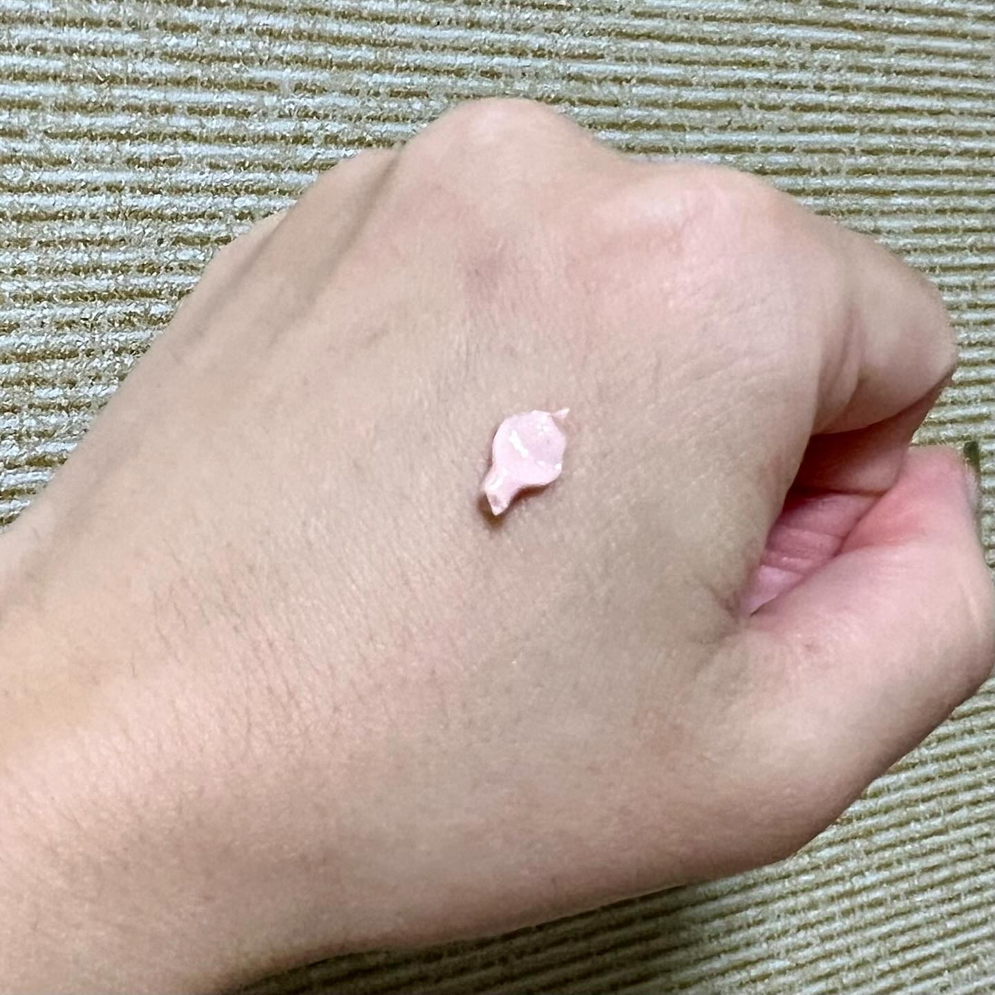 トフメルA（医薬品）/三宝製薬/その他を使ったクチコミ（2枚目）