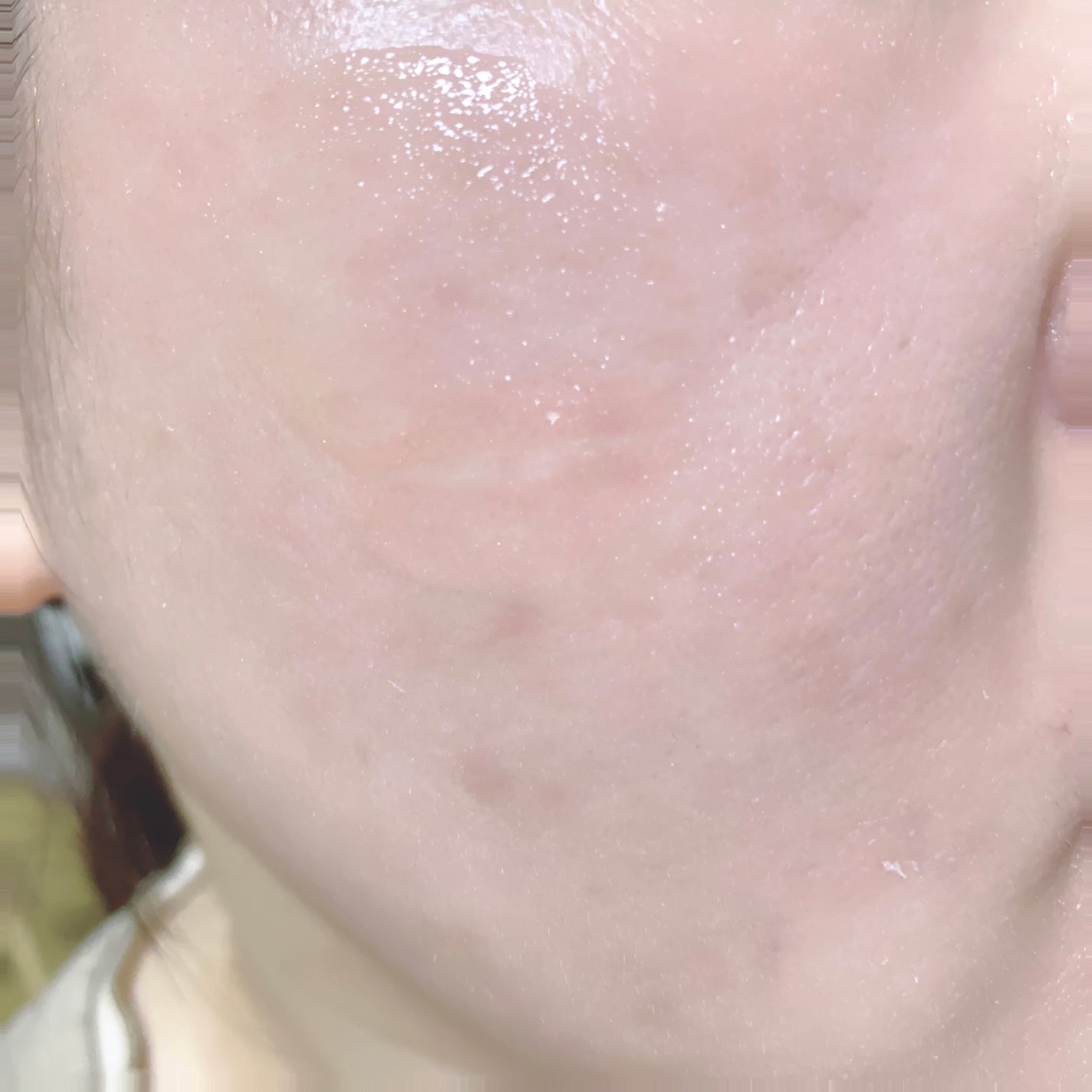 シークレットくすみセラム/Aetem /美容液を使ったクチコミ(6枚目)