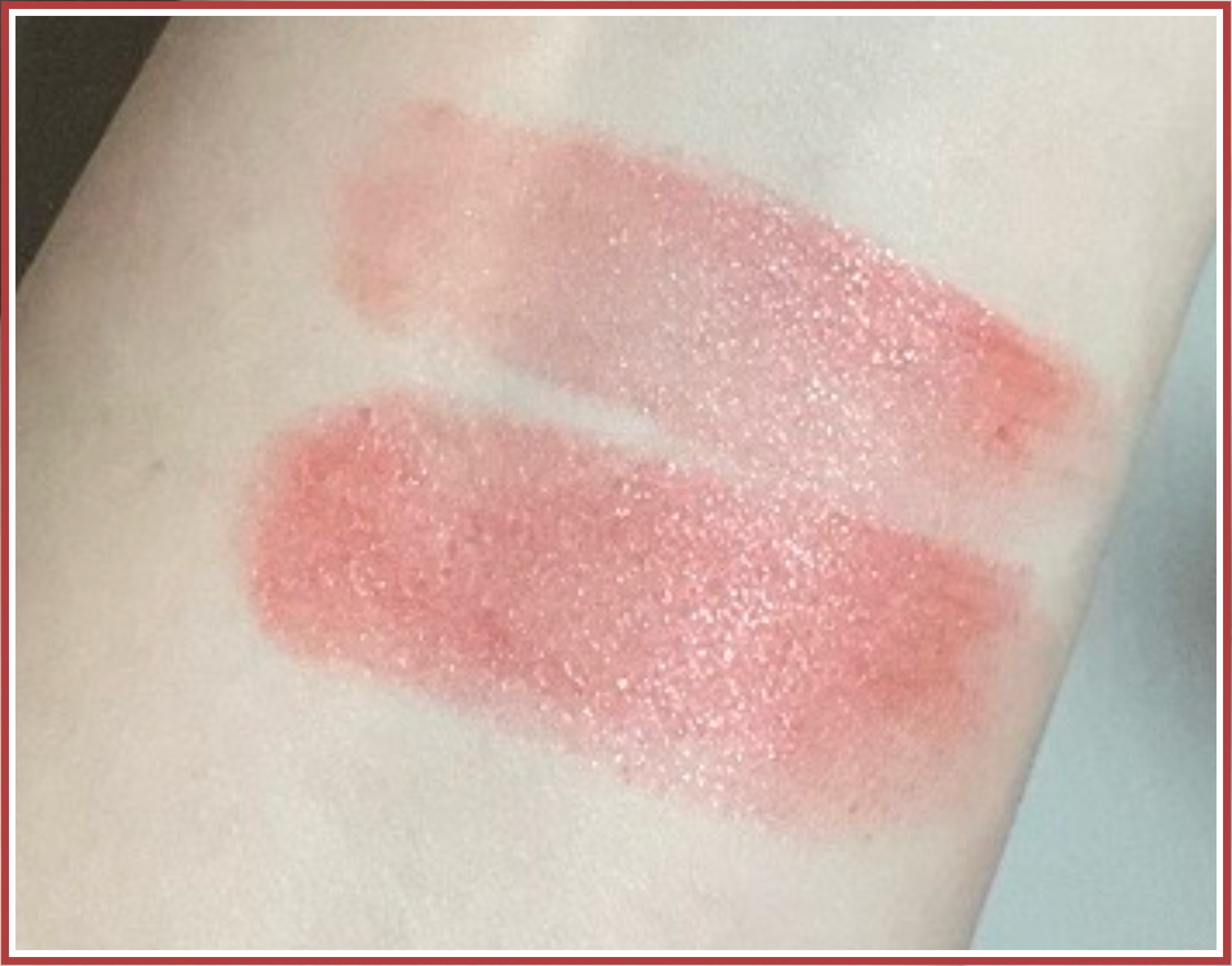 AC メルティバーム/AC MAKEUP/口紅を使ったクチコミ（2枚目）