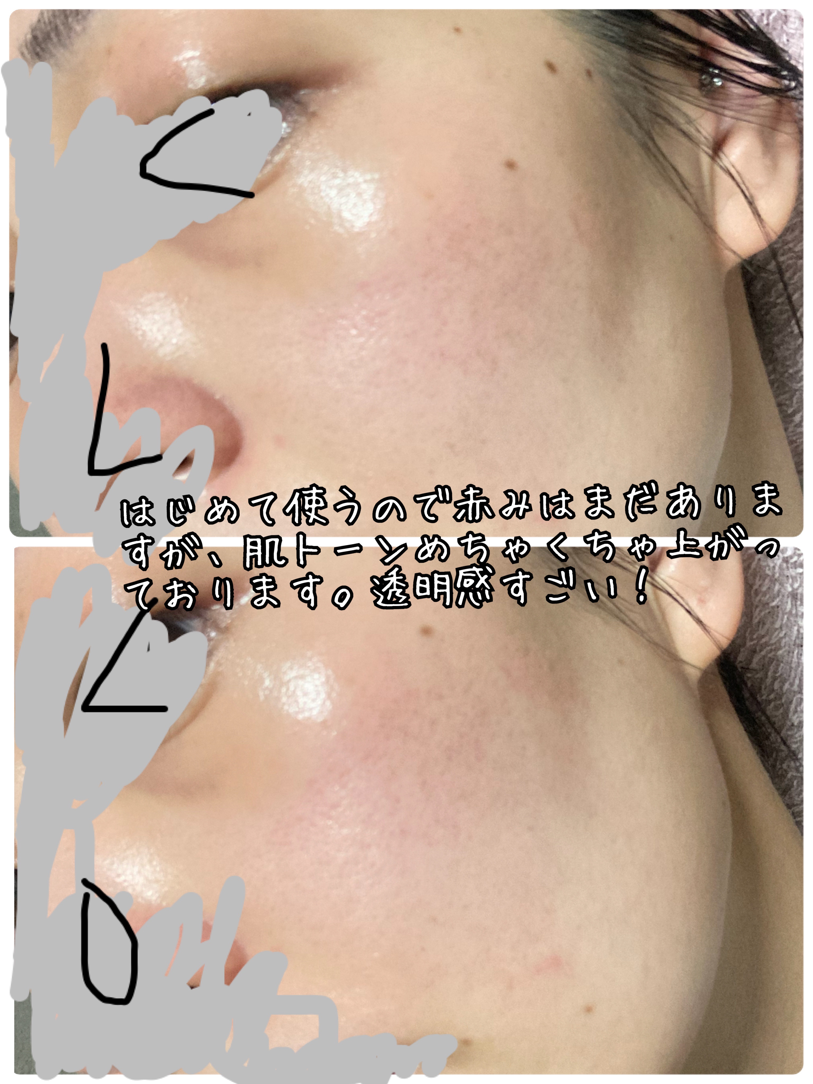 ピンクアロエムチンセラム/APRILSKIN/美容液を使ったクチコミ（2枚目）