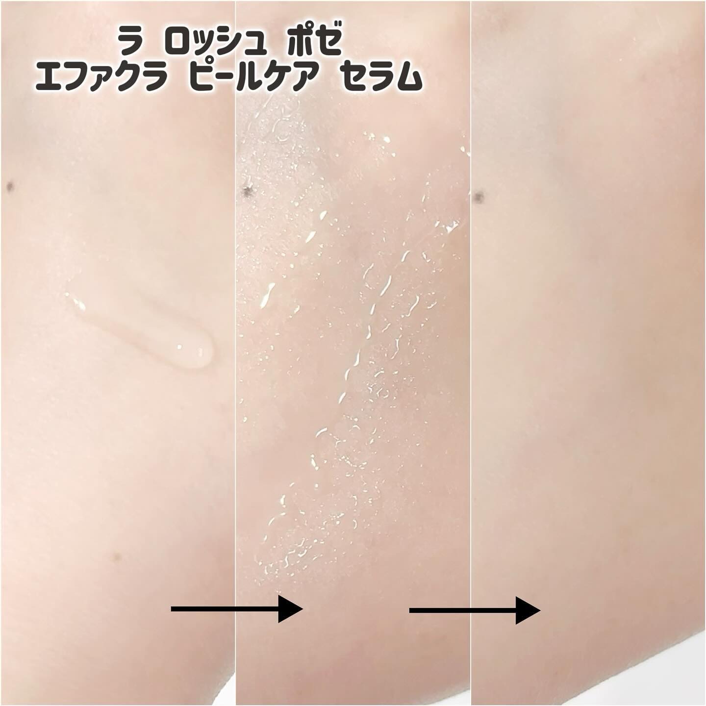 エファクラ ピールケア セラム/ラ ロッシュ ポゼ/美容液を使ったクチコミ（3枚目）