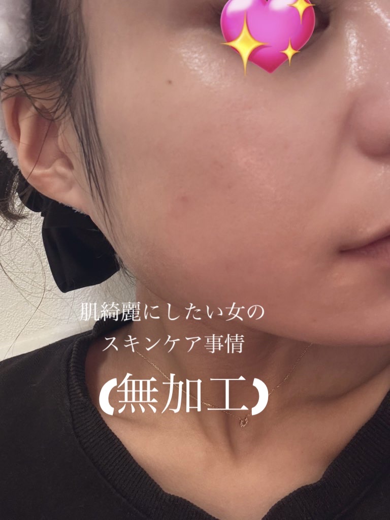 モイスチャー ミストローションII（しっとり）/アルージェ/ミスト状化粧水を使ったクチコミ（1枚目）