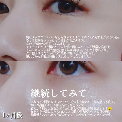 リードルショット300/VT/美容液を使ったクチコミ(9枚目)