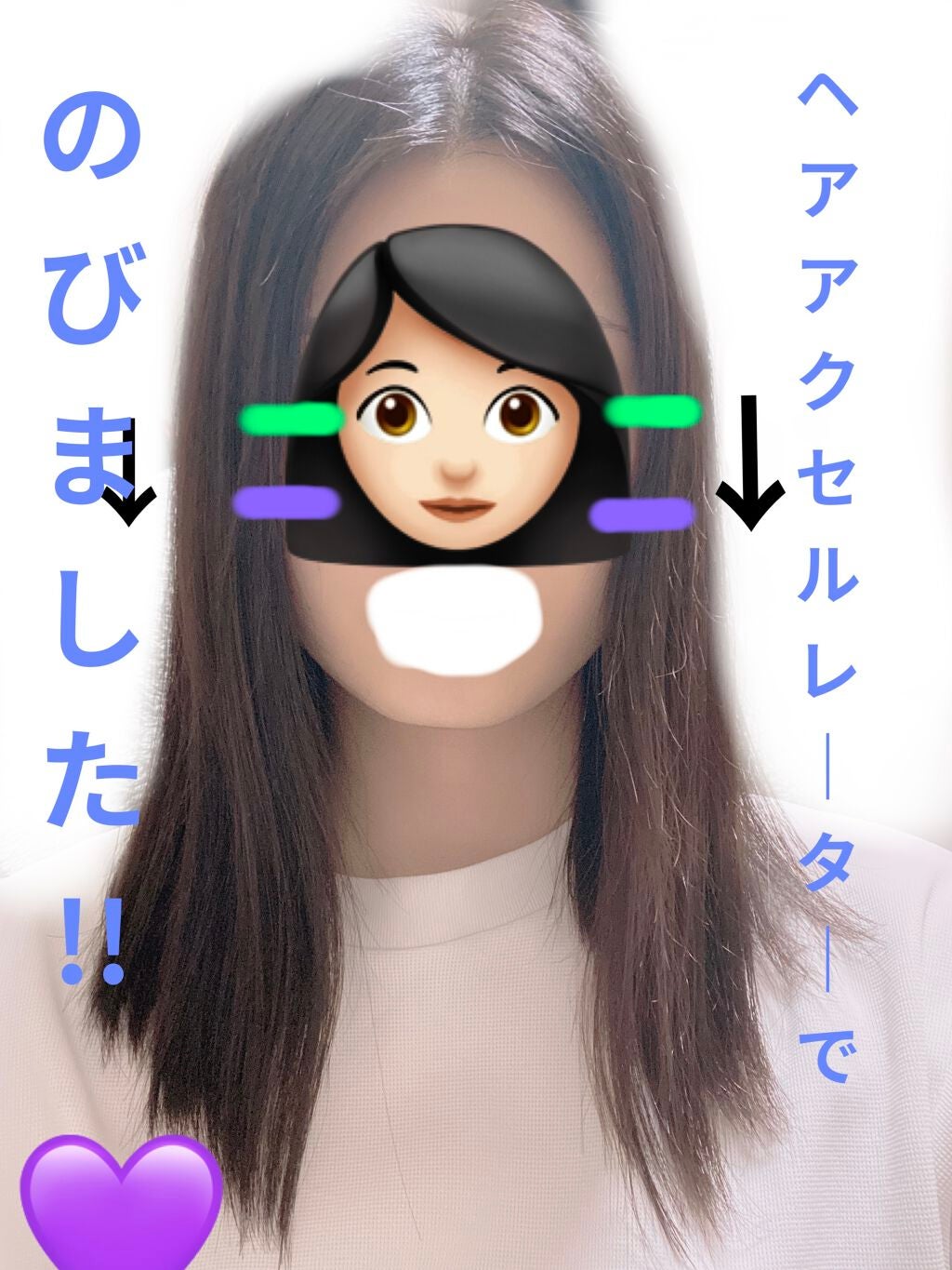 ヘアアクセルレーターEX フローラルアップルの香り/加美乃素本舗/頭皮ローションを使ったクチコミ(1枚目)