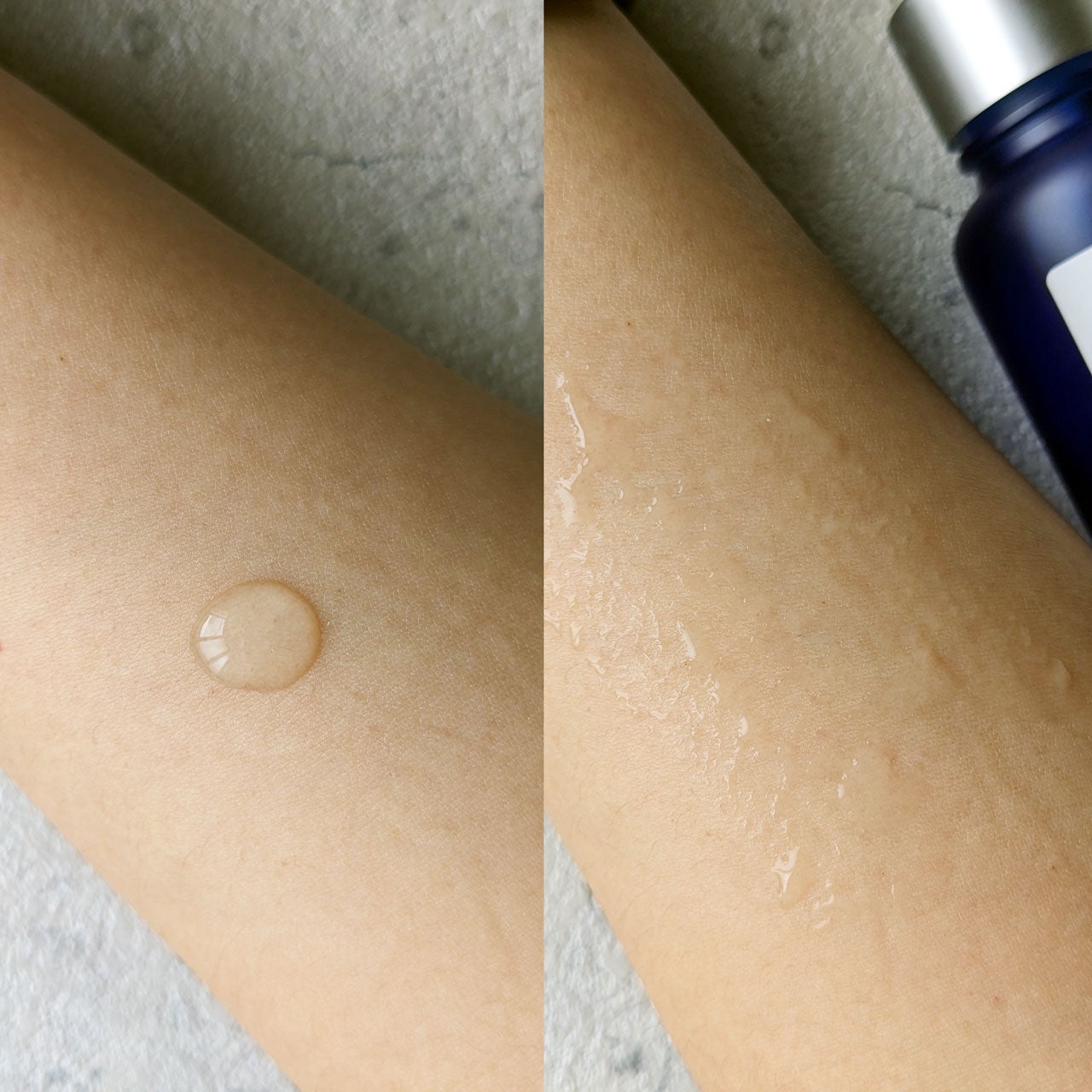 タカミスキンピール/タカミ/ブースター・導入液を使ったクチコミ(4枚目)