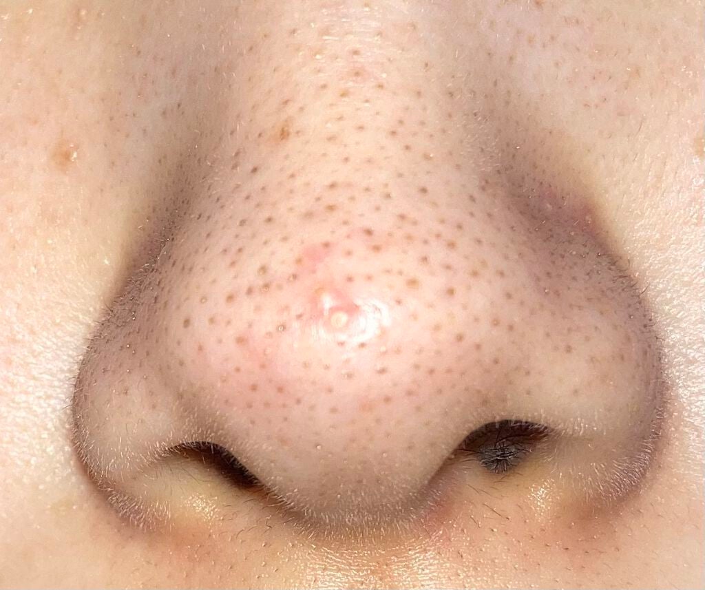 デュオ ザ クレンジングバーム クリア/DUO/クレンジングバームを使ったクチコミ(2枚目)