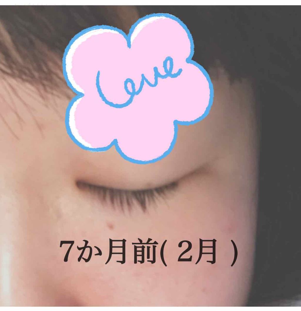 アデノバイタル アイラッシュセラム/資生堂プロフェッショナル/まつげ美容液を使ったクチコミ（3枚目）