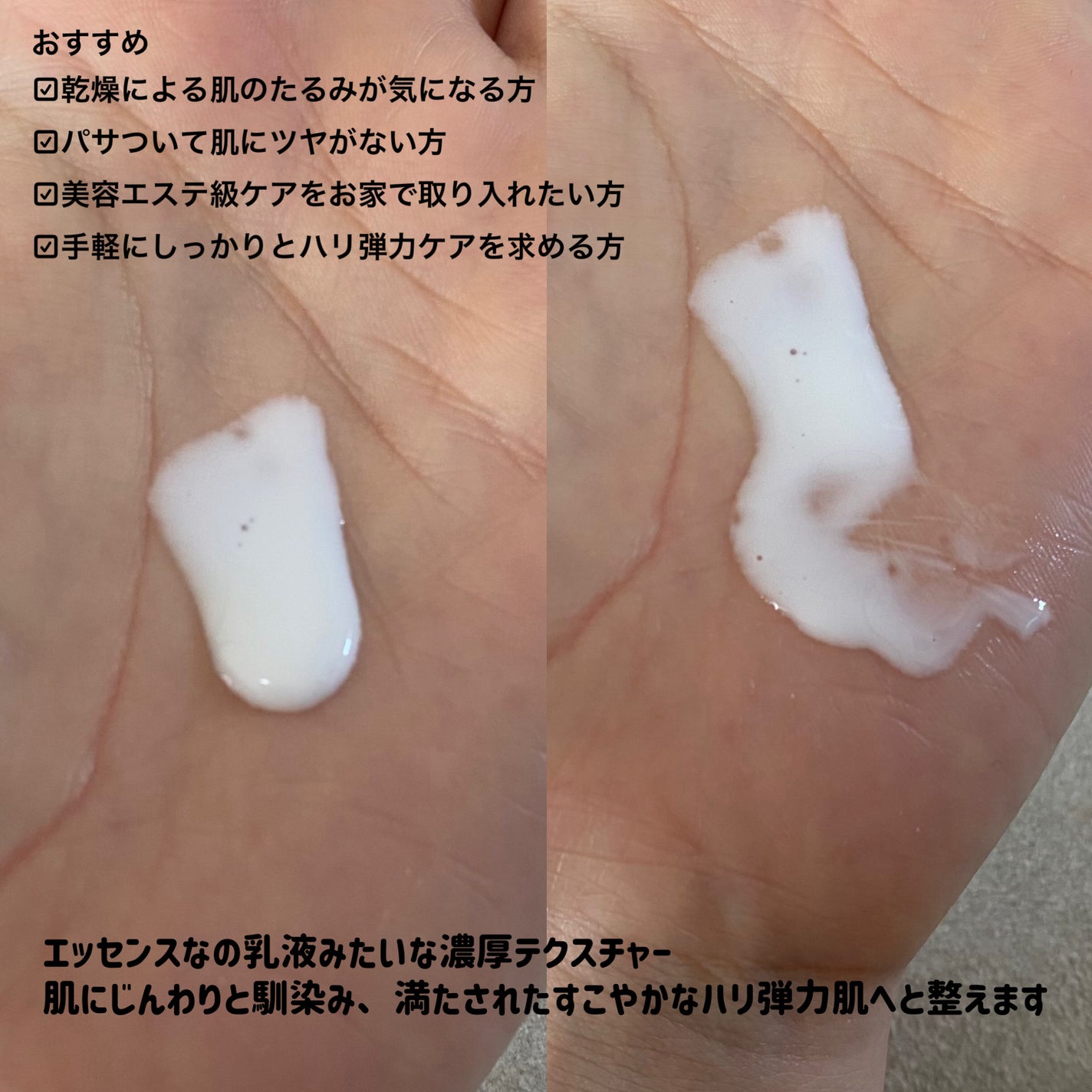 ピーディーアールエヌエッセンス PDRN 100/VT/美容液を使ったクチコミ(2枚目)