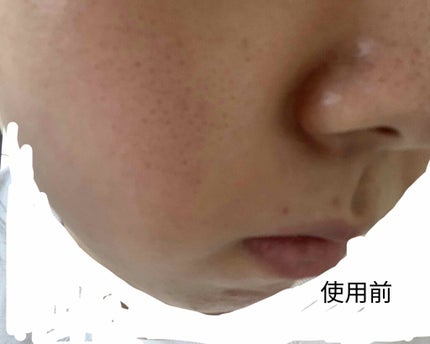 エリクシール ルフレ バランシング ミルク II/エリクシール/乳液を使ったクチコミ(2枚目)