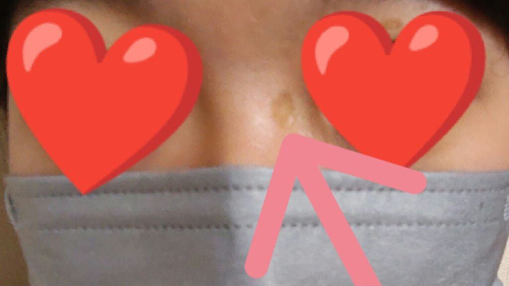 コンシーラークレヨンUV/CEZANNE/ペンシルコンシーラーを使ったクチコミ(2枚目)