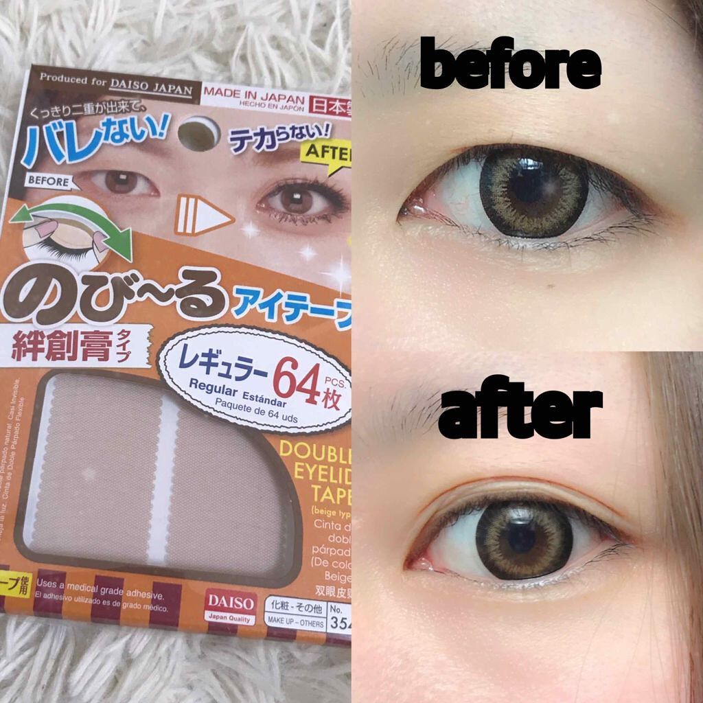 のびーるアイテープ（絆創膏タイプ、レギュラー）/DAISO/二重まぶた用アイテムを使ったクチコミ（1枚目）