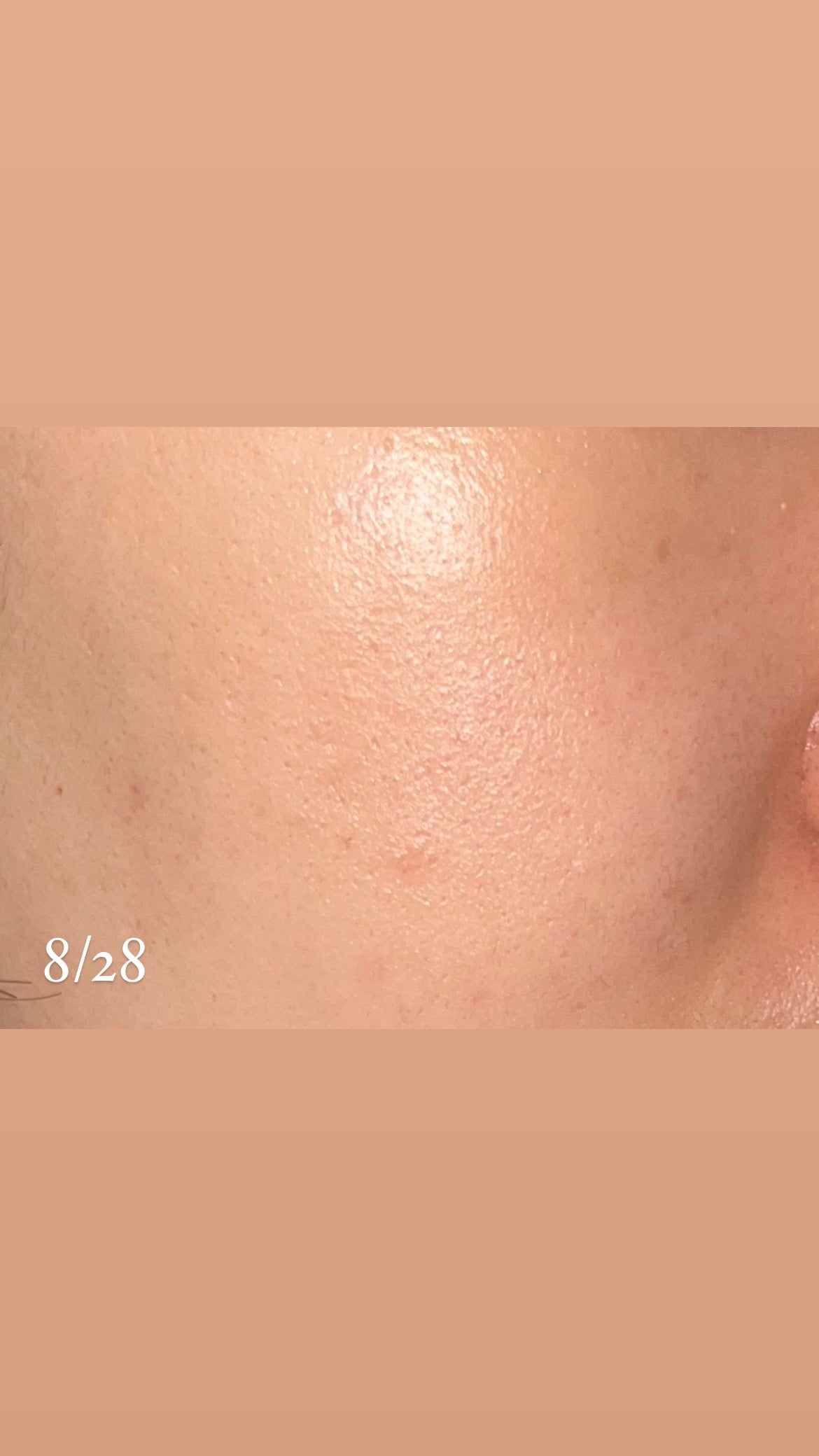 リードルショット100/VT/美容液を使ったクチコミ(4枚目)