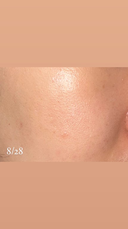 リードルショット100/VT/美容液を使ったクチコミ(4枚目)