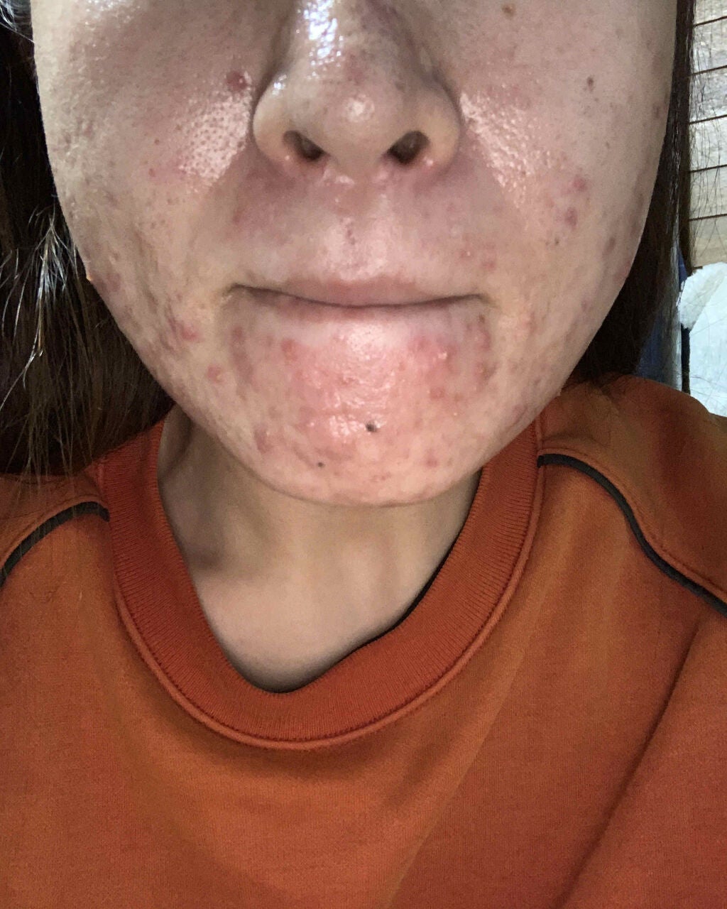 アルソア クイーンシルバー/アルソア/洗顔石鹸を使ったクチコミ(3枚目)