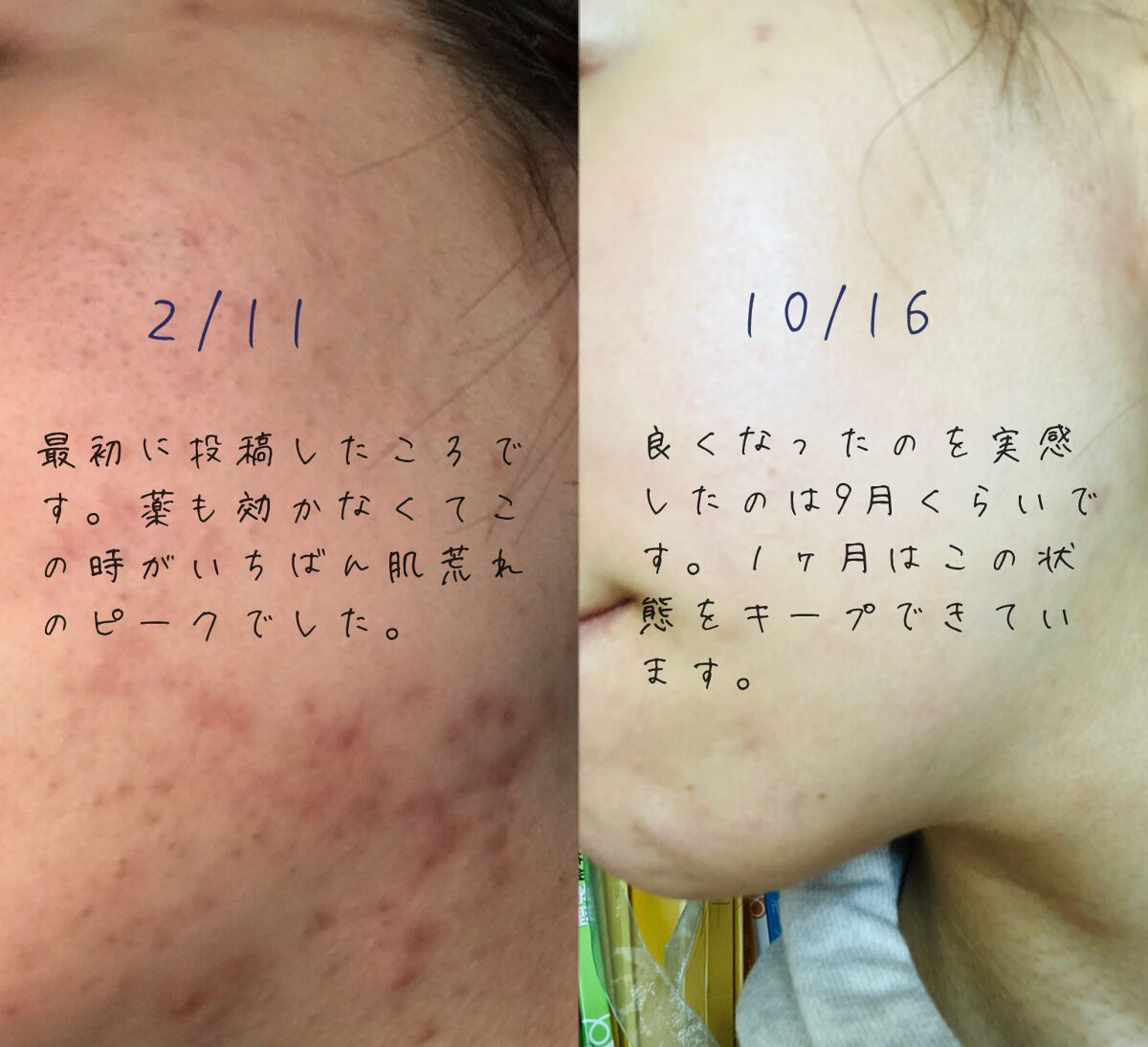 DHC 薬用ディープクレンジングオイル/DHC/オイルクレンジングを使ったクチコミ（2枚目）