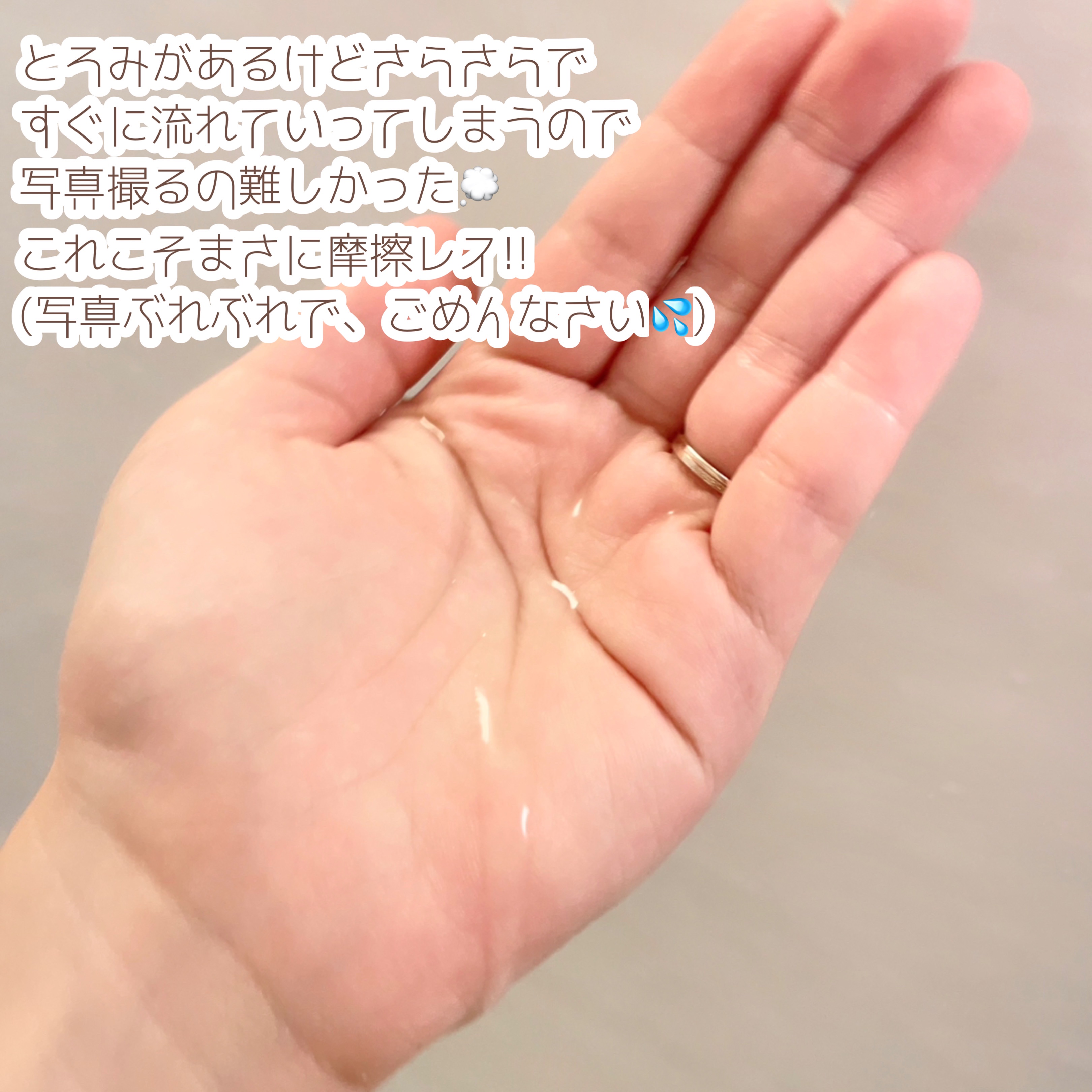 エファクラ ピールケア セラム/ラ ロッシュ ポゼ/美容液を使ったクチコミ（2枚目）