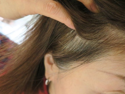 ナノグロウリッチ/iqumore/頭皮ローションを使ったクチコミ(2枚目)