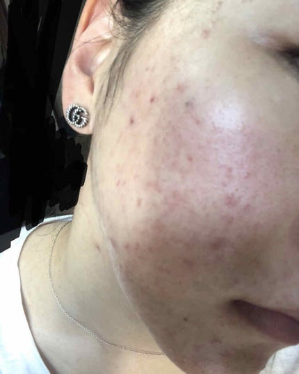 ザ・タイムR アクア/IPSA/化粧水を使ったクチコミ(4枚目)