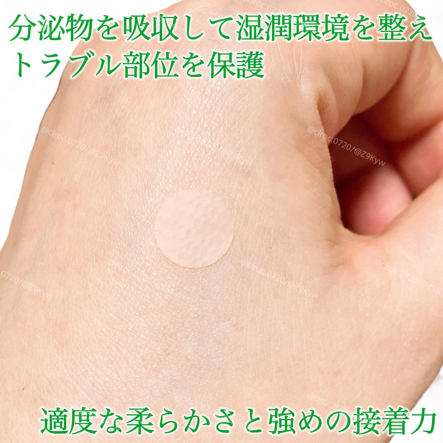 SPOT PATCH ロールタイプ/Shupong/にきびパッチを使ったクチコミ（3枚目）