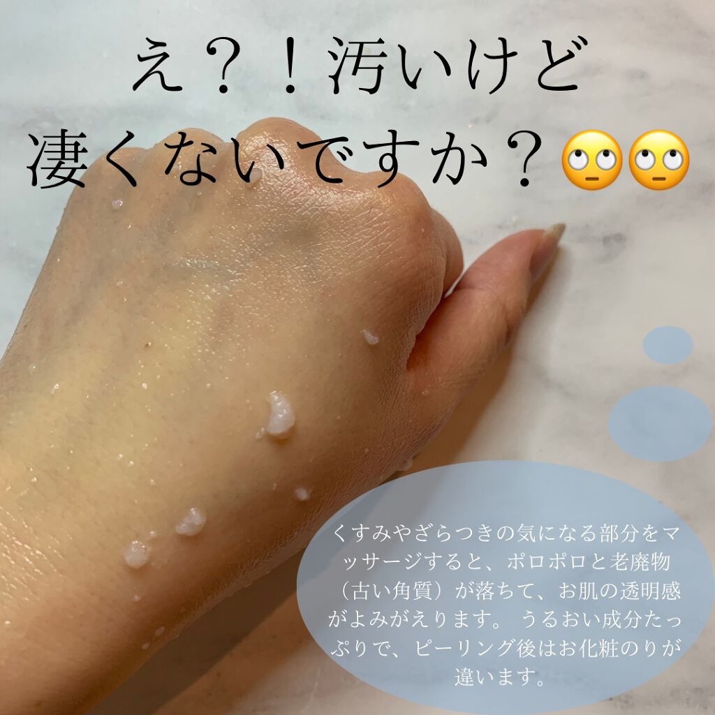 DETクリア ブライト&ピール ピーリングジェリー<ミックスフルーツの香り>/Detclear/ピーリングを使ったクチコミ(3枚目)