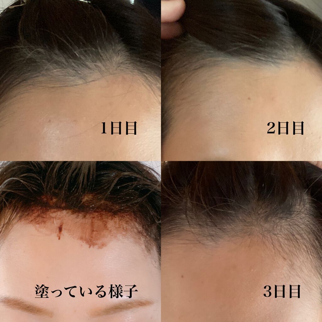 フラガール カラートリートメント フラガールの口コミ フラガールカラートリートメント カラーキ By Yumi フォロバ 普通肌 30代後半 Lips