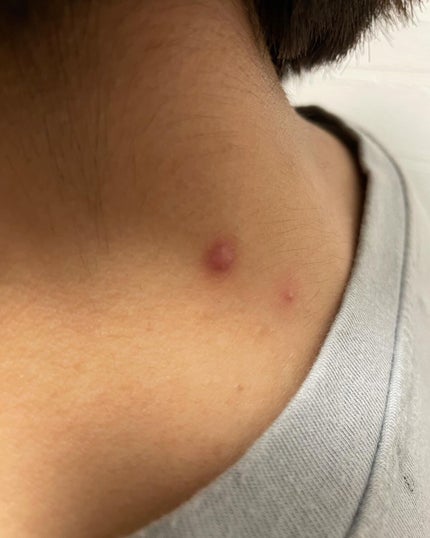 AHA·BHA·PHA 30デイズミラクルアクネボディクレンザー/SOME BY MI/ボディソープを使ったクチコミ(4枚目)