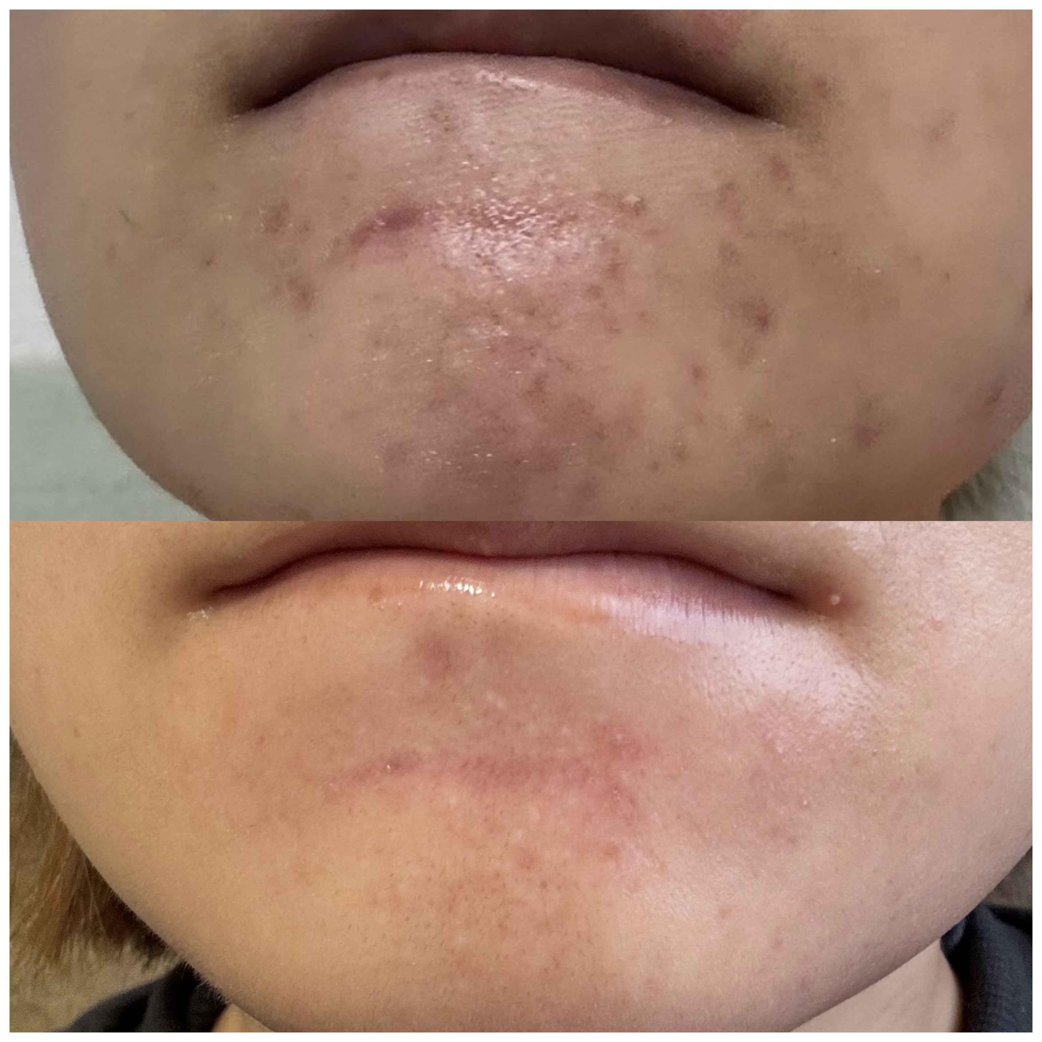 モイスト クレンジング クリーム/IGNIS/クレンジングクリームを使ったクチコミ（2枚目）