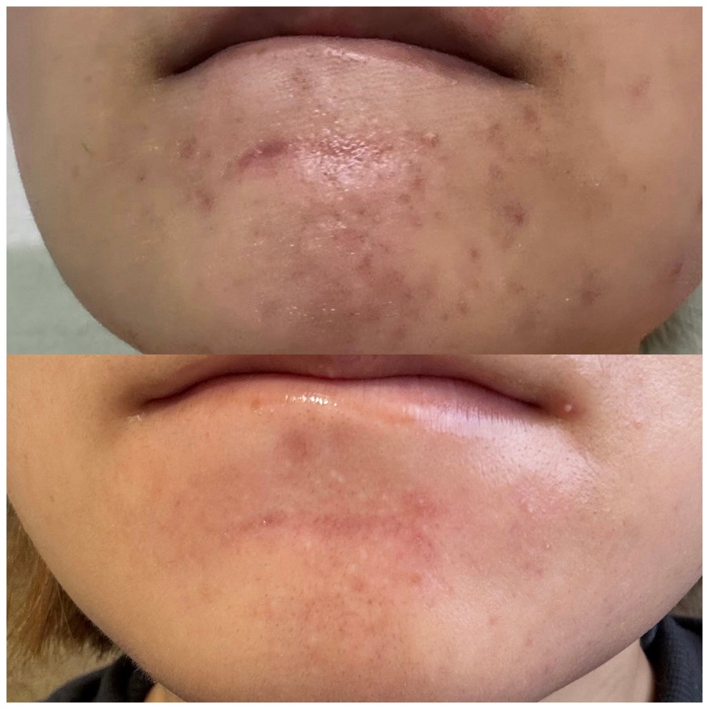 モイスト クレンジング クリーム/IGNIS/クレンジングクリームを使ったクチコミ(2枚目)