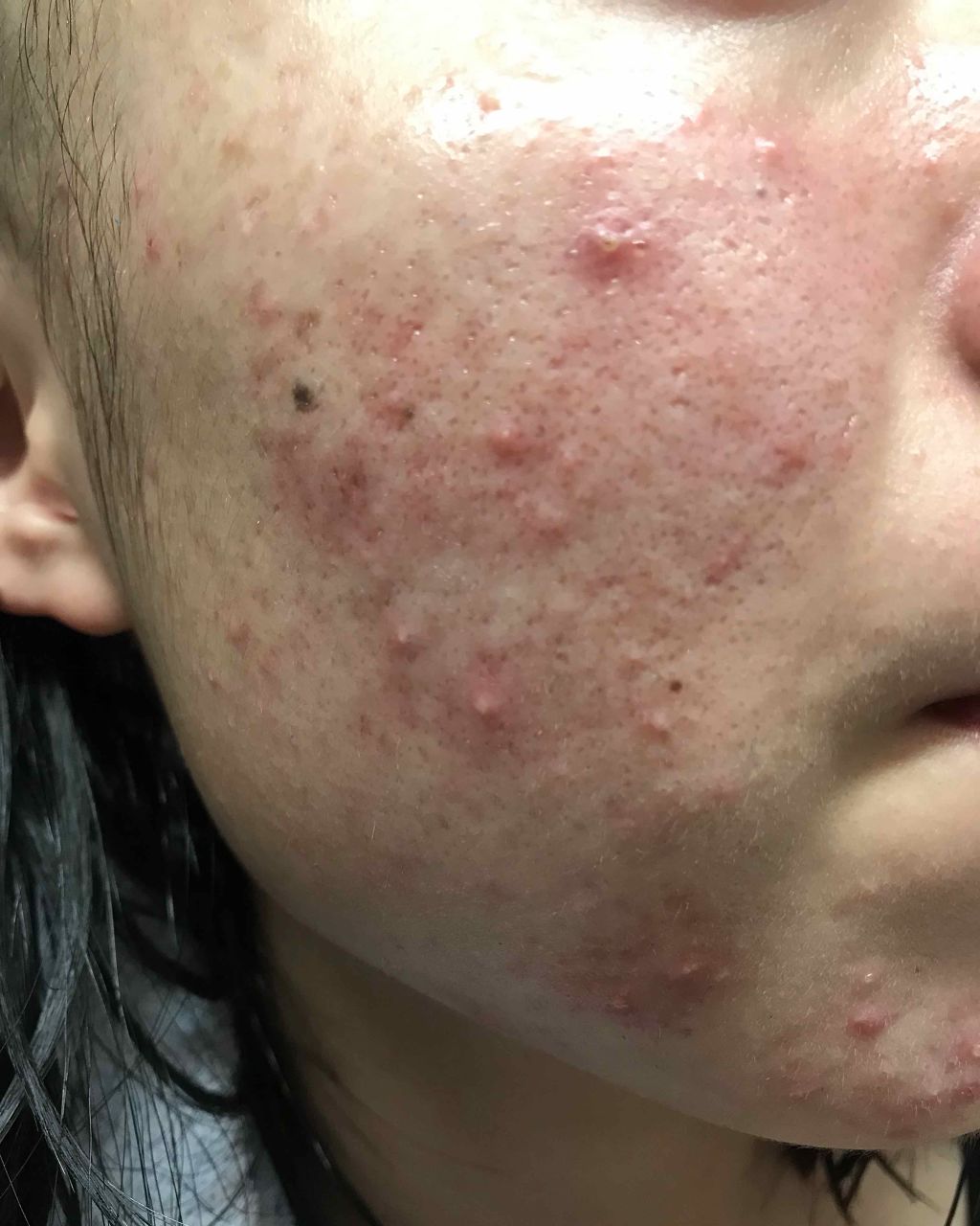 ドクタージャルト シカペア クリーム （第2世代）/Dr.Jart＋/フェイスクリームを使ったクチコミ（2枚目）