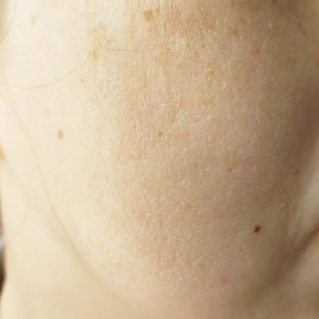 シルクマスク/エルツティン/シートマスク・パックを使ったクチコミ(4枚目)