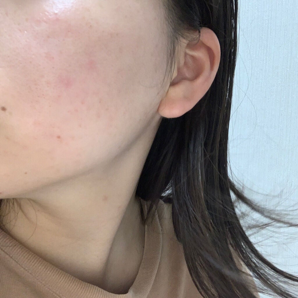 fresh_make_ghl0 on LIPS 「こんにちは!敏感肌の18歳高校3年生です。2枚目が今年の5月、..」(3枚目)