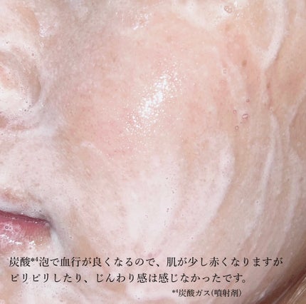 マイクロムース リフレッシャー/ALBLANC/泡洗顔を使ったクチコミ(5枚目)